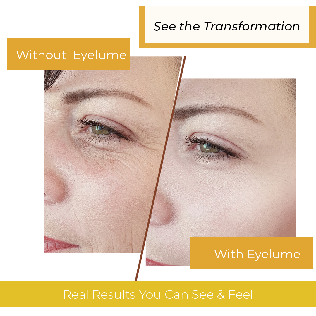 EyeLume 24K Gel Eye Patches